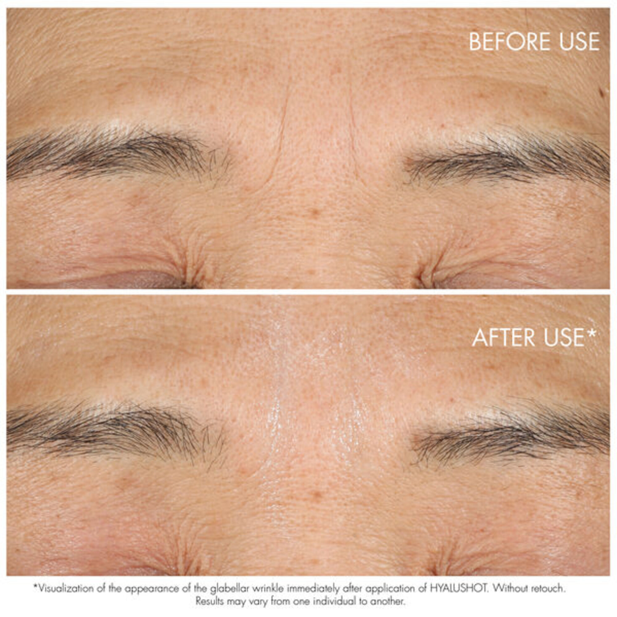 Corector pentru riduri Capture Totale Hyalushot