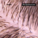300 ML L'OREAL PROFESSIONNEL SCALP ADVANCED Sampon profesional pentru scalp gras  5 of 6 Sampon profesional pentru scalp gras