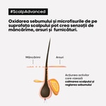 300 ML L'OREAL PROFESSIONNEL SCALP ADVANCED Sampon pentru scalp sensibil 2 of 3 Sampon pentru scalp sensibil