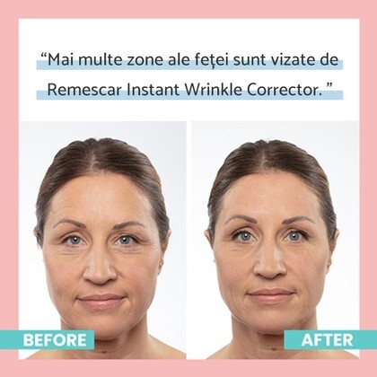 Corector instant pentru riduri Wrinkle Corrector