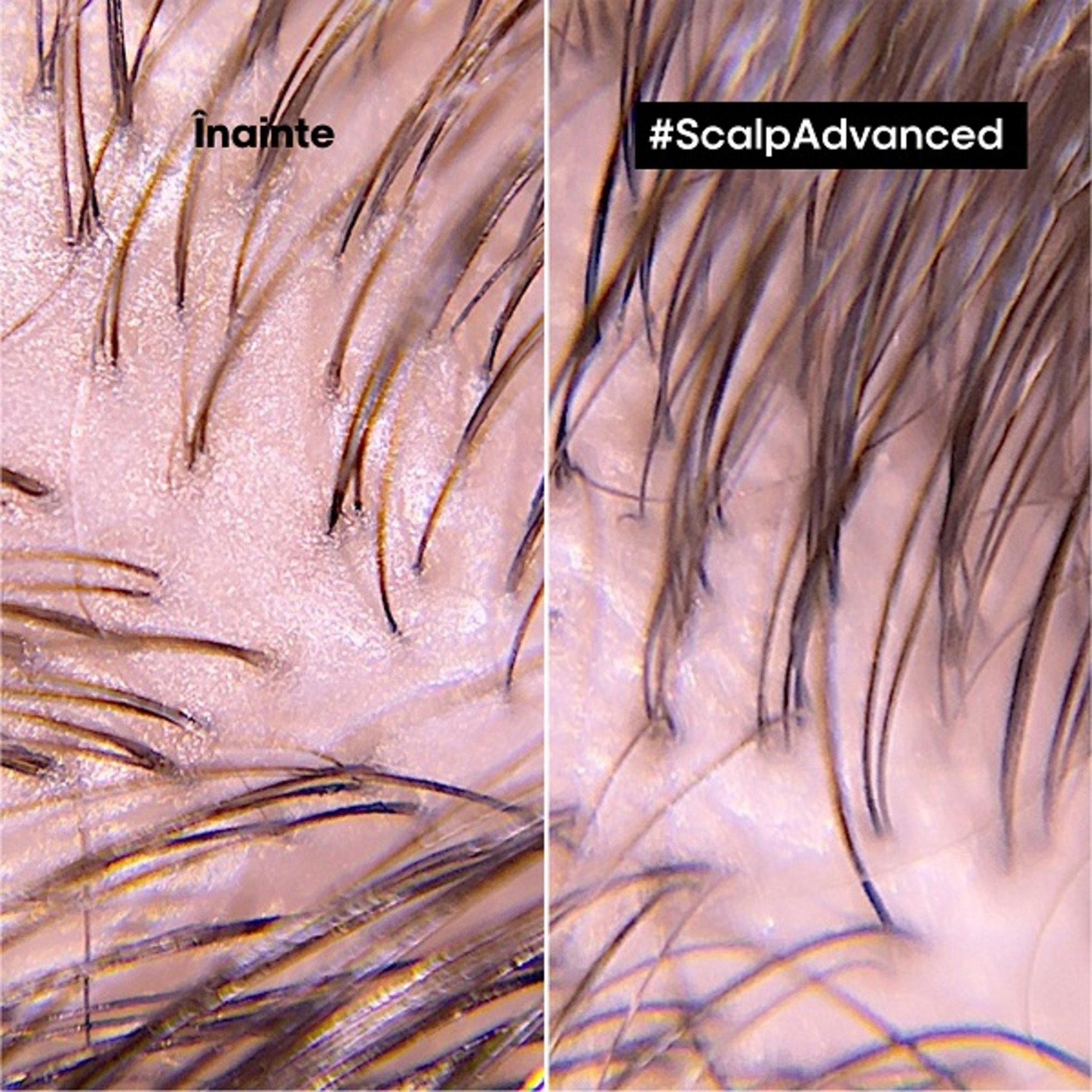 Sampon profesional pentru scalp gras