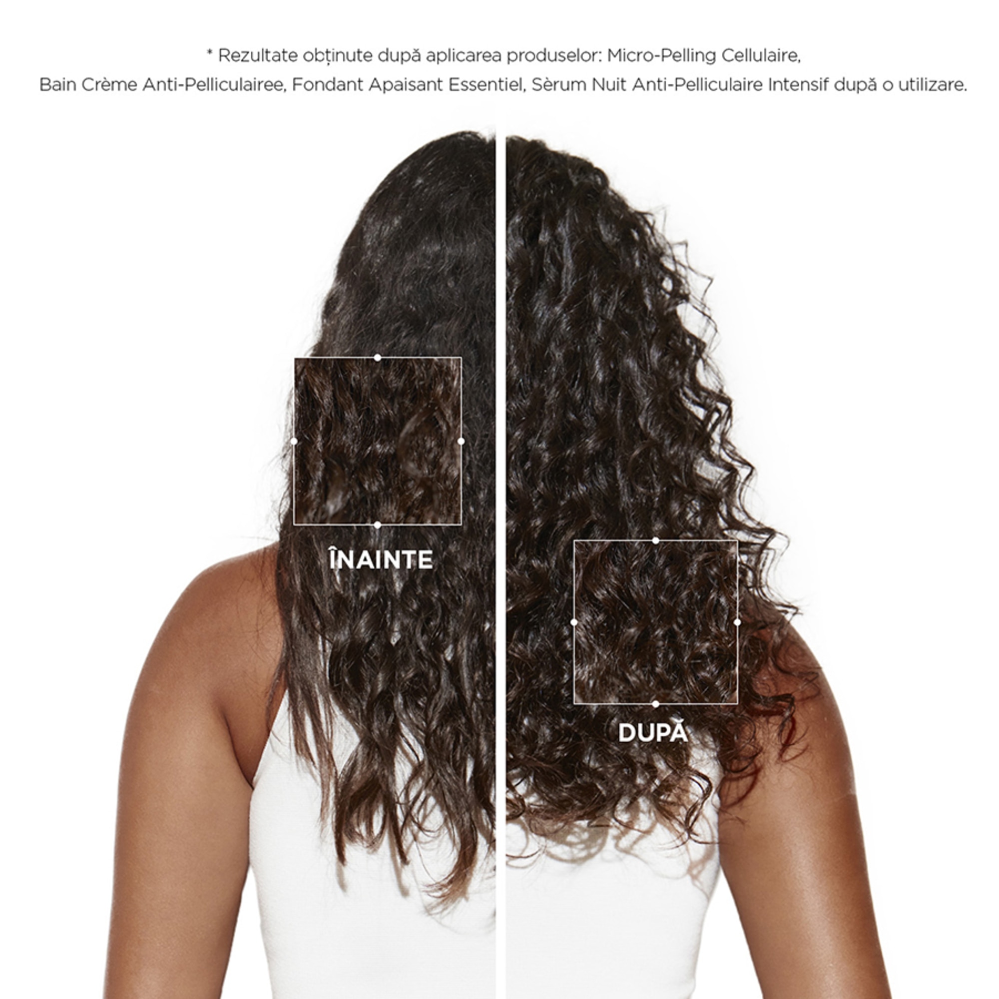 Sampon anti matreata intens hidratant Anti Pelliculaire